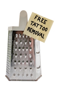 free tattoo removal