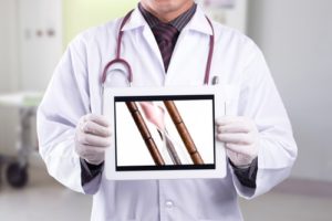 doctor holding up an iPad screen displaying medical animation