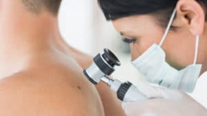 Closeup of dermatologist examining mole on back of male patient in clinic